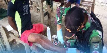 Alami Luka Robek Terkena Kapak, Albertinus Kasipmabin Diobati Tim Kesehatan Yonif 310/KK