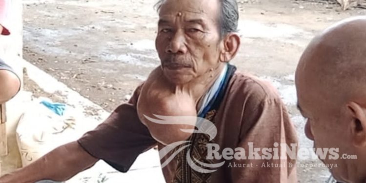 Pria Penderita Tumor Ganas Warga Jampangkulon Sukabumi, Butuh Uluran Tangan Dermawan