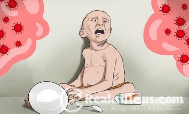 Seorang Balita di Sukabumi, Terancam Kekurangan Asupan Gizi, Dampak Kesulitan Ekonomi