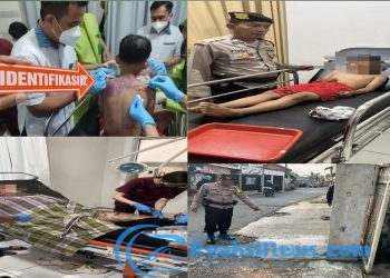 Pengendara Motor di Kota Sukabumi Seorang Ibu dan Anak Jadi Korban Penyiraman Air Keras Oleh Orang Tidak Dikenal, Ini Penjelasannya