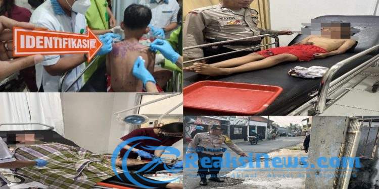 Pengendara Motor di Kota Sukabumi Seorang Ibu dan Anak Jadi Korban Penyiraman Air Keras Oleh Orang Tidak Dikenal, Ini Penjelasannya