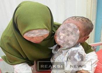 Bocah 7 Tahun di Sukabumi, Pengidap Penyakit Langka Candidiasis, Tidak Ada Bantuan Pemerintah, cek faktanya