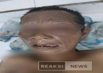 Sat Lantas Simalungun Cari Keluarga Korban Tabrak Lari: Wanita Tanpa Identitas Meninggal di Jalan Umum Nagori Dolok Kahean