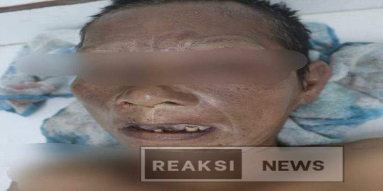 Sat Lantas Simalungun Cari Keluarga Korban Tabrak Lari: Wanita Tanpa Identitas Meninggal di Jalan Umum Nagori Dolok Kahean