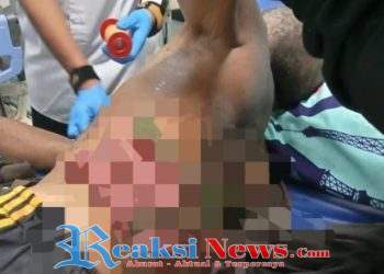 Tragis Seorang Pria Alami Luka Parah di Perut, Tertusuk Bambu Usai Menebangnya