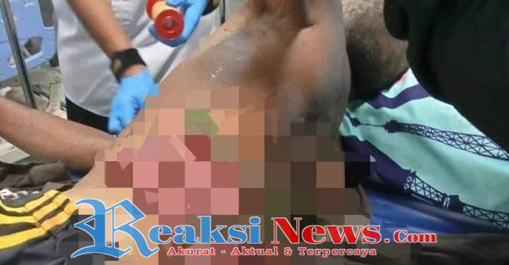 Tragis Seorang Pria Alami Luka Parah di Perut, Tertusuk Bambu Usai Menebangnya